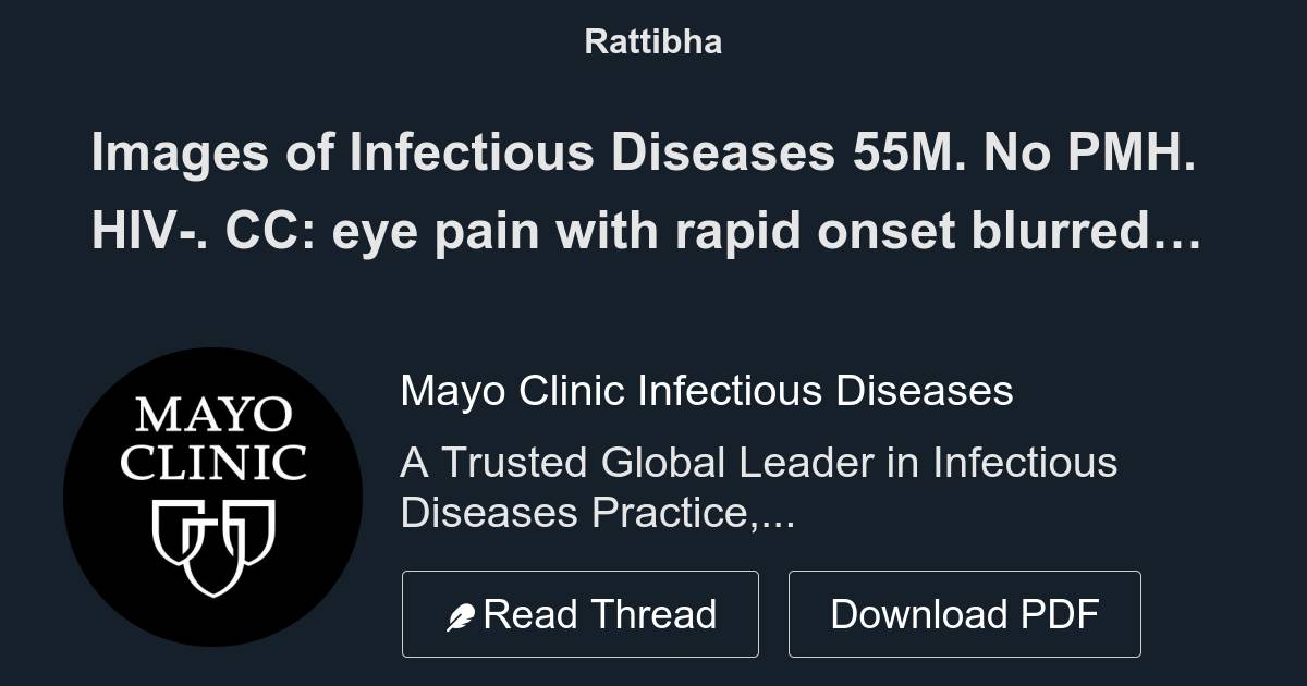 Images of Infectious Diseases 55M. No PMH. HIV. CC eye pain with