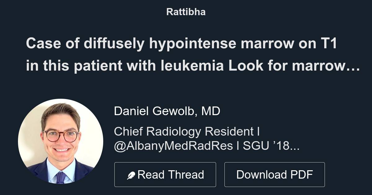 Case of diffusely hypointense marrow on t1 in this patient with